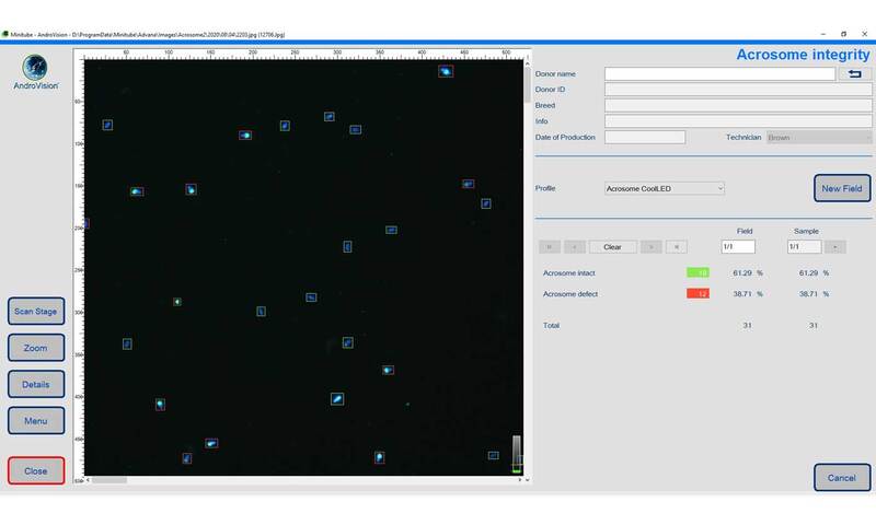 AndroVision® software module: Acrosome Integrity