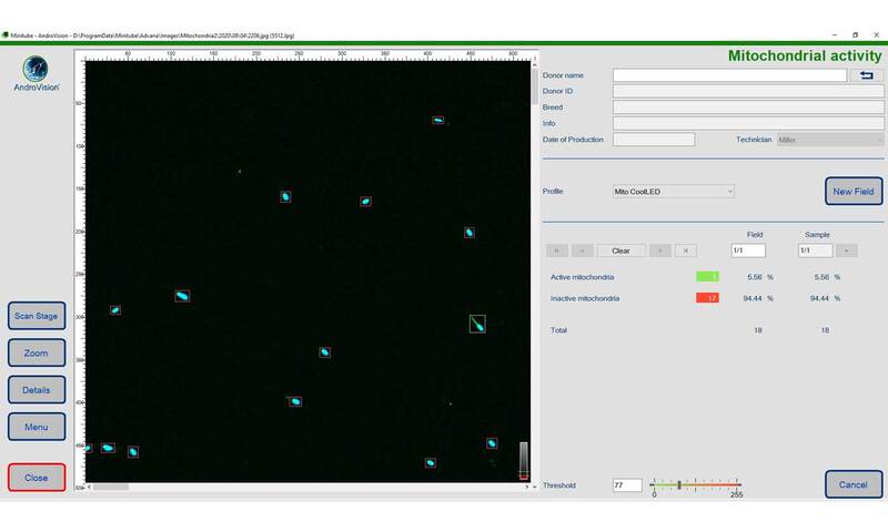 AndroVision® software module: Activity of Mitochon