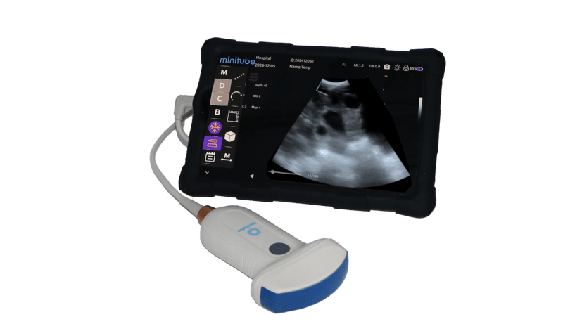 Minitube Ultrasound scanner 3.0-2