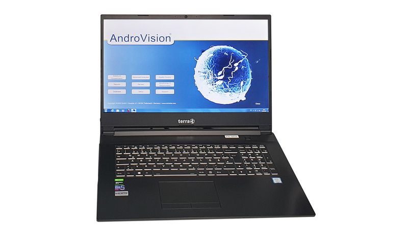 AndroVision®: CASA software with laptop