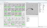 AndroVision® software module: Morphology & Morphom